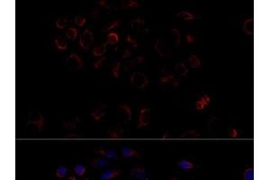 Immunofluorescence (IF) image for anti-ATP Synthase, H+ Transporting, Mitochondrial F1 Complex, beta Polypeptide (ATP5B) antibody (ABIN7010818)