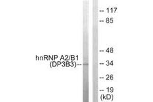 Western Blotting (WB) image for anti-Heterogeneous Nuclear Ribonucleoprotein A2/B1 (HNRNPA2B1) (AA 1-50) antibody (ABIN2889424) (HNRNPA2B1 抗体  (AA 1-50))