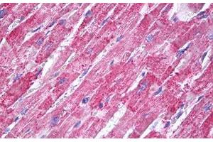 Image no. 2 for anti-Superoxide Dismutase 2, Mitochondrial (SOD2) antibody (ABIN1496289) (SOD2 抗体)