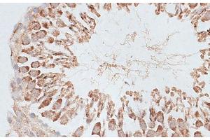 Immunohistochemistry of paraffin-embedded Rat testis using KIF2C Polyclonal Antibody at dilution of 1:100 (40x lens).