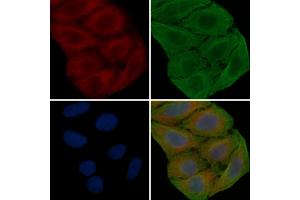 ABIN6259956 and ABIN6276843 staining Hela cells(30 min of UV treatment) by IF/ICC.