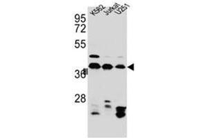 Western blot analysis of HNRNPC Antibody (C-term) in Jurkat,K562,U251 cell line lysates (35ug/lane). (HNRNPC 抗体  (C-Term))