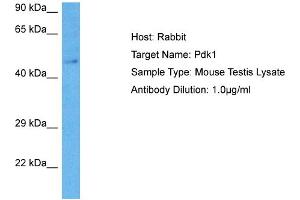 Host: Rabbit Target Name: PDK1 Sample Tissue: Mouse Testis Antibody Dilution: 1ug/ml (PDPK1 抗体  (Middle Region))