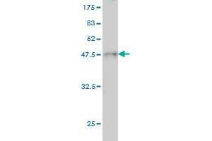 Western Blot detection against Immunogen (36. (RPSA/Laminin Receptor 抗体  (AA 196-295))