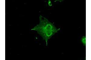 Anti-CRYAB mouse monoclonal antibody (ABIN2452606) immunofluorescent staining of COS7 cells transiently transfected by pCMV6-ENTRY CRYAB (RC202718). (CRYAB 抗体)