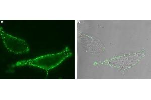 Immunocytochemistry (ICC) image for anti-Transient Receptor Potential Cation Channel, Subfamily V, Member 6 (TRPV6) (AA 395-405), (Extracellular) antibody (ABIN7043856)