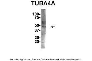 IP Suggested Anti-TUBA4A Antibody Positive Control: NT2 CELL/BRAIN TISSUE (TUBA4A 抗体  (Middle Region))