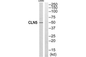 Western Blotting (WB) image for anti-Ceroid-Lipofuscinosis, Neuronal 5 (CLN5) (Internal Region) antibody (ABIN1851078) (CLN5 抗体  (Internal Region))