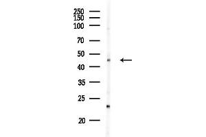 anti-SRY (Sex Determining Region Y)-Box 11 (SOX11) (C-Term) antibody