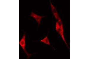 ABIN6274760 staining A549 cells by IF/ICC. (RPS8 抗体  (C-Term))