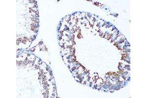 Immunohistochemistry of paraffin-embedded Mouse testis using MAP1LC3A Polyclonal Antibody at dilution of 1:100 (20x lens). (MAP1LC3A 抗体)
