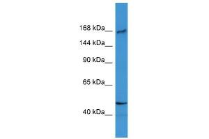 WB Suggested Anti-BTBD12 Antibody Titration: 0. (BTBD12 抗体  (N-Term))