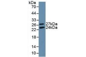 Detection of Recombinant GSS, Human using Polyclonal Antibody to Glutathione Synthetase (GSS) (Glutathione Synthetase 抗体  (AA 268-474))