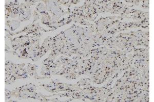 ABIN6272611 at 1/100 staining Human lung tissue by IHC-P. (CSNK1G3 抗体  (N-Term))