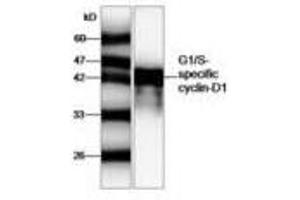 Image no. 1 for anti-Cyclin D1 (CCND1) antibody (ABIN791463) (Cyclin D1 抗体)