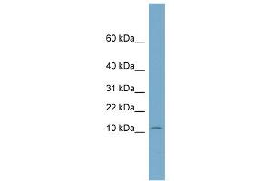 WB Suggested Anti-NOLA3 Antibody Titration: 0. (Nop10 抗体  (Middle Region))