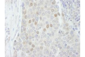 Immunohistochemistry (IHC) image for anti-RNA Binding Motif Protein 27 (RBM27) (AA 700-750) antibody (ABIN7448764) (RBM27 抗体  (AA 700-750))
