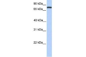 WB Suggested Anti-COLEC12 Antibody Titration:  0. (COLEC12 抗体  (Middle Region))