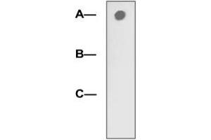 1 µg peptide was blot onto NC membrane (A: LRP5 (pT1492); B: LRP5 (non-phospho); C: Non-related phosphopeptide) was blotted by LRP5 (phospho T1492) polyclonal antibody  at 1:2000 dilution.