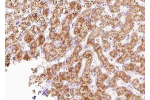 ABIN6268827 at 1/100 staining human liver tissue sections by IHC-P. (CXCR4 抗体  (C-Term))