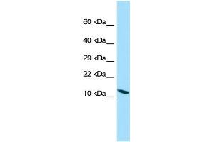 WB Suggested Anti-PPP1R14D Antibody Titration: 1. (PPP1R14D 抗体  (N-Term))