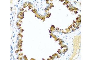 Immunohistochemistry of paraffin-embedded Mouse lung using NRG4 Polyclonal Antibody at dilution of 1:100 (40x lens). (Neuregulin 4 抗体)