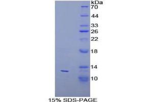 SDS-PAGE analysis of Human PEX2 Protein. (PEX2 蛋白)