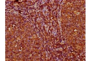 IHC image of ABIN7156094 diluted at 1:200 and staining in paraffin-embedded human tonsil tissue performed on a Leica BondTM system. (IGKC 抗体  (AA 1-107))