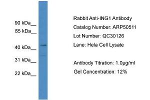 WB Suggested Anti-ING1  Antibody Titration: 0. (ING1 抗体  (N-Term))