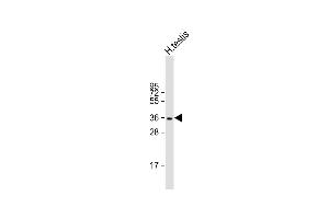 Anti-WBP2NL Antibody (N-term) at 1:1000 dilution + human testis lysate Lysates/proteins at 20 μg per lane. (WBP2NL 抗体  (N-Term))