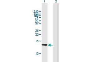 Western Blot analysis of HCP5 expression in transfected 293T cell line by HCP5 MaxPab polyclonal antibody. (HCP5 抗体  (AA 1-132))
