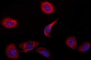 ABIN6263233 and ABIN6272850 staining Hela by IF/ICC.