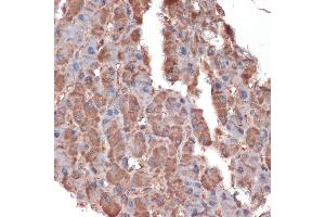 Immunohistochemistry of paraffin-embedded human liver using Apolipoprotein C3 Rabbit mAb (ABIN7265640) at dilution of 1:100 (40x lens).