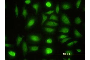 Immunofluorescence of monoclonal antibody to NPEPL1 on HeLa cell. (NPEPL1 抗体  (AA 1-523))