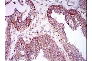 Immunohistochemistry (IHC) image for anti-Hyaluronan Synthase 2 (HAS2) (AA 67-170) antibody (ABIN1098124)