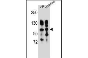 ITGA5 Antibody (Center) (ABIN656138 and ABIN2845477) western blot analysis in human uterine tumor and mouse bladder tissue lysates (35 μg/lane). (ITGA5 抗体  (AA 575-602))