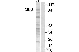 Immunohistochemistry analysis of paraffin-embedded human brain tissue using DIL-2 antibody. (TPX2 抗体)