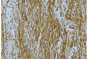 ABIN6275682 at 1/100 staining Mouse muscle tissue by IHC-P.
