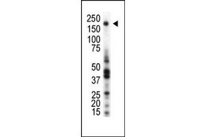 Image no. 1 for anti-Macrophage Stimulating 1 Receptor (C-Met-Related tyrosine Kinase) (MST1R) (AA 22-51), (C-Term), (N-Term) antibody (ABIN359935) (MST1R 抗体  (C-Term, N-Term))