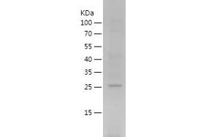 Western Blotting (WB) image for Peroxiredoxin 6 (PRDX6) (AA 2-224) protein (His tag) (ABIN7124368) (Peroxiredoxin 6 Protein (PRDX6) (AA 2-224) (His tag))