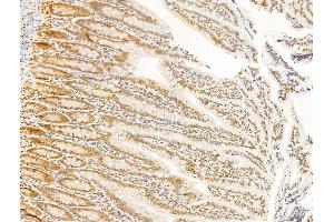 ABIN6265564 and ABIN6273020 at 1/100 staining Rat colon tissue by IHC-P. (TIA1 抗体  (Internal Region))