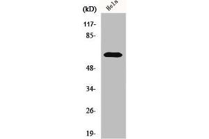 Western Blot analysis of HeLa cells using KOX11 Polyclonal Antibody (ZNF18 抗体  (Internal Region))