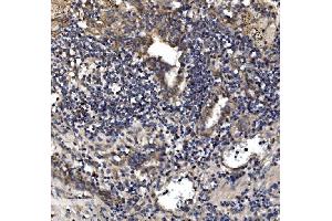 IHC analysis of Astrin/Deepest/SPAG5 using anti-Astrin/Deepest/SPAG5 antibody (ABIN7602399). (SPAG5 抗体  (AA 738-1193))
