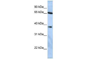 WB Suggested Anti-USP3 Antibody Titration:  0. (USP3 抗体  (Middle Region))