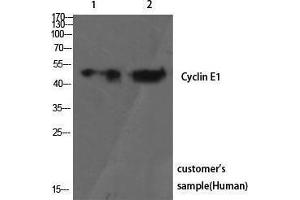 Western Blotting (WB) image for anti-Cyclin E1 (CCNE1) (Ser21) antibody (ABIN3174622) (Cyclin E1 抗体  (Ser21))