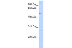 Image no. 1 for anti-Protein Phosphatase 1M (PP2C Domain Containing) (PPM1M) (AA 72-121) antibody (ABIN6741162) (PPM1M 抗体  (AA 72-121))