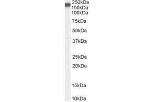 Image no. 1 for anti-Nitric Oxide Synthase 1, Neuronal (NOS1) (C-Term) antibody (ABIN374142) (NOS1 抗体  (C-Term))