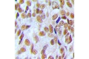 Immunohistochemistry (IHC) image for anti-U2 Small Nuclear RNA Auxiliary Factor 1 (U2AF1) antibody (ABIN7308460) (U2AF1 抗体)