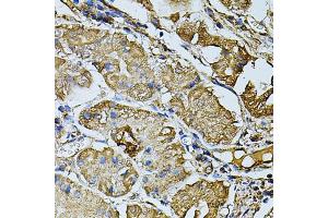 Immunohistochemistry of paraffin-embedded human stomach using CDH6 antibody (ABIN5974784) at dilution of 1/100 (40x lens). (CDH6 抗体)