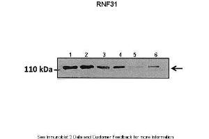 Lanes:   Lane1: 50 ug hormoxia A549 lysate Lane2: 50 ug hypoxia A549 lysate Lane3: 50 ug hormoxia A549 lysate (+scrambled siRNA) Lane4: 50 ug hypoxia A549 lysate (+scrambled siRNA) Lane5: 50 ug hormoxia A549 lysate (RNF31 siRNA) Lane6: 50 ug hypoxia A549 lysate (RNF31 siRNA)  Primary Antibody Dilution:   1:800  Secondary Antibody:   Goat anti rabbit HRP   Secondary Antibody Dilution:   1:10000  Gene Name:   RNF31  Submitted by:   Markus Queisser, Northwestern University (RNF31 抗体  (Middle Region))